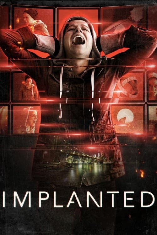 İmplant izle
